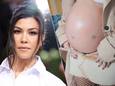 Kourtney Kardashian laat voor het eerst litteken van spoedoperatie tijdens haar zwangerschap zien