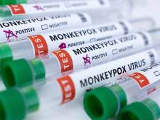Un premier cas de variole du singe confirmé en Ukraine
