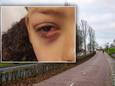 Xivano fietste op de Heideweg in Amersfoort toen hij vuurwerk naar zich gegooid kreeg. Het ontplofte in zijn gezicht en mogelijk is hij aan één oog blind.