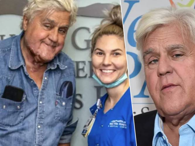 Jay Leno geeft update na motorongeluk en garagebrand: “Het gaat goed met me”