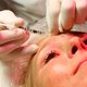 Plastisch chirurgen waarschuwen voor missers bij cosmetische behandelingen