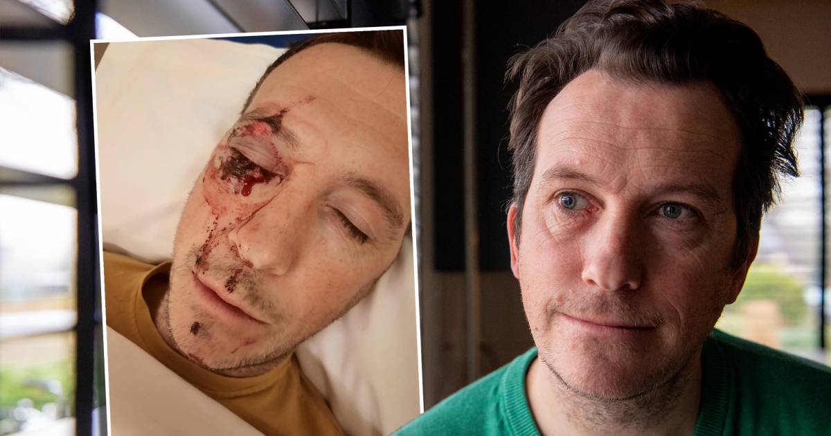 Snoeiharde vuistslag op oog heeft grote gevolgen voor René uit Balkbrug, dader krijgt taakstraf.