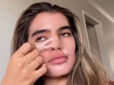 Elle fait croire que la peau pèle pendant les règles: un canular pas si drôle