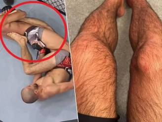 KIJK. “Ik voelde knie wel zeven keer kraken”: UFC-vechter weigert op te geven nadat been hélemaal plooit, maar deze foto toont de gevolgen