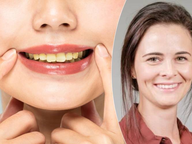 Wat eet je best niet uit voorzorg om gele tanden te vermijden? 3 tandspecialisten leggen uit: “Als je elk halfuur iets eet, beschadig je je tanden”