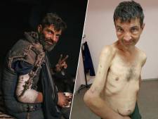 Oekraïense strijder van iconische foto in fabriek Azovstal overleeft belegering en krijgsgevangenschap, maar is fysiek nog maar schim van zichzelf