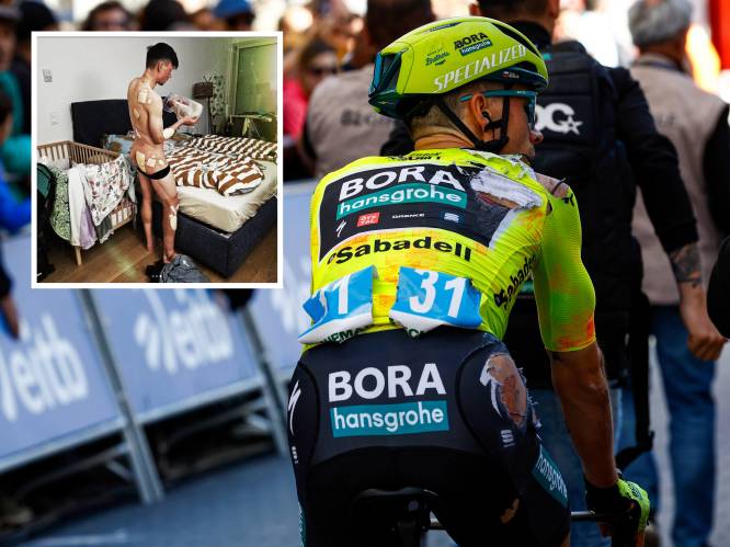 Spiernaakte Primoz Roglic toont sporen van zware val in Ronde van het Baskenland: ‘Voel me weer wat beter’