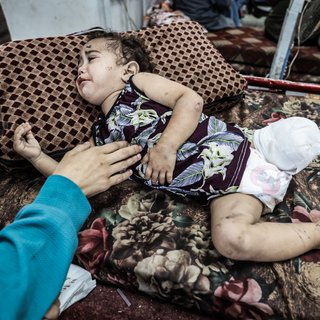 Artsen zien ernstige wonden in Gaza door inzet explosieve wapens