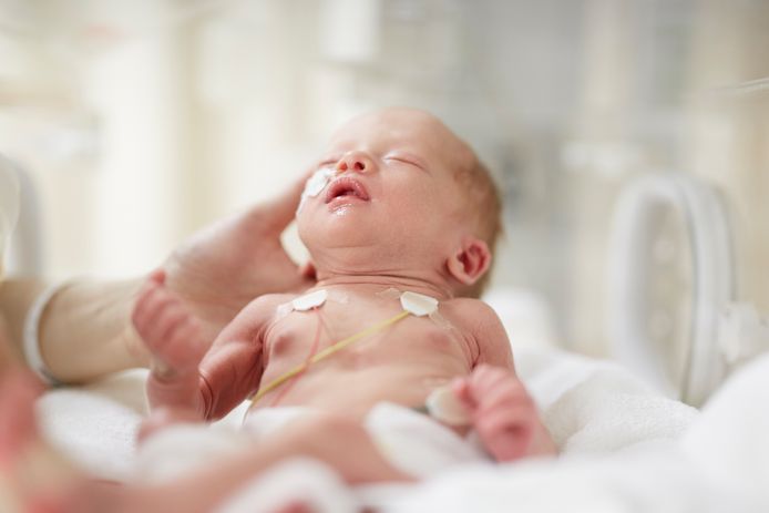 Het percentage baby’s dat vóór de 37e week van de zwangerschap wordt geboren ligt in Nederland 6,6 procent.