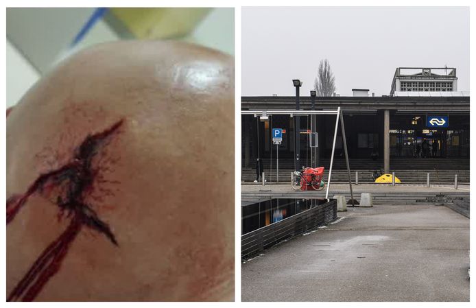 Enschedeër dient klacht in na valpartij op het Stationsplein in Enschede. De man kreeg tien hechtingen in zijn hoofd.