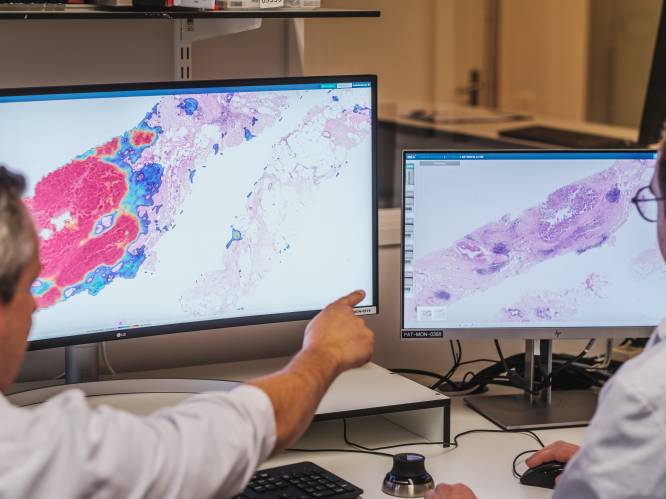 Het einde van de microscoop? Antwerps ziekenhuis gebruikt als eerste in Benelux artificiële intelligentie om kankercellen op te sporen: “Een extra paar virtuele ogen dat meekijkt”