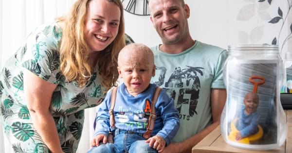 Hugo (1) uit Westerhaar heeft de hele dag jeuk - Tubantia