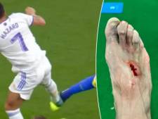 L’intervention rugueuse d’Eden Hazard, fracture du pied pour Akapo