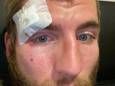 Slachtoffer Xander (25) liep een gapende hoofdwonde op door de brutale aanval.
