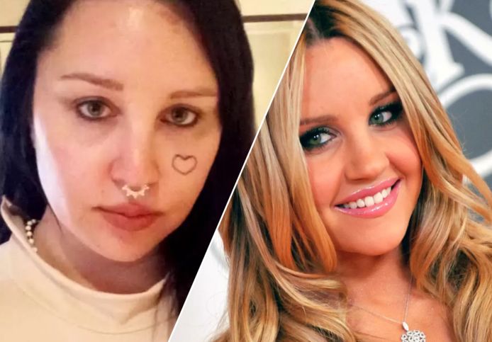 amanda bynes plastic surgery