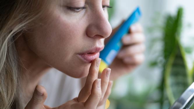 Droge en gebarsten lippen? Dit helpt volgens dermatologen het beste