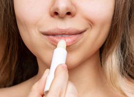 Last van droge lippen? Dit kun je eraan doen
