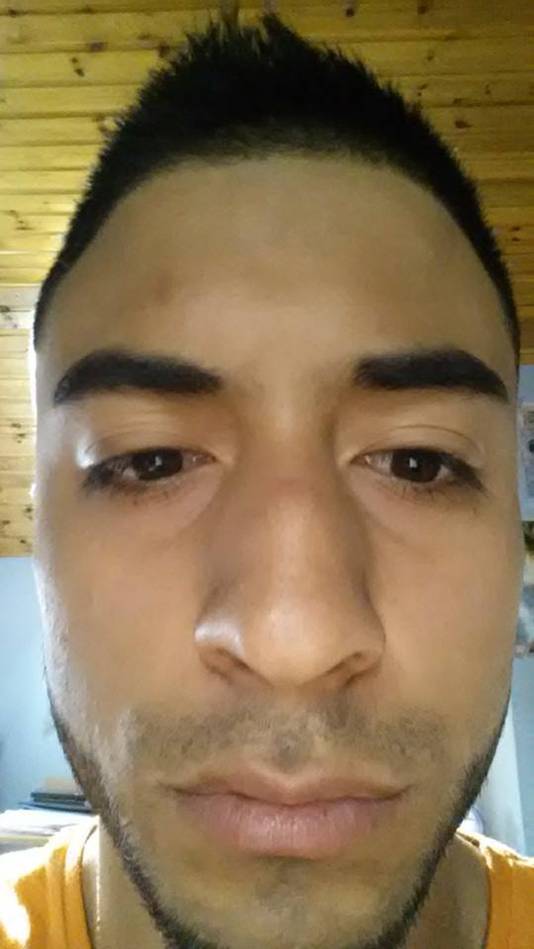 Joueur Agresse Par Son Coequipier A Le Nez Casse Je Vais Porter Plainte Hors Jeu 7sur7 Be
