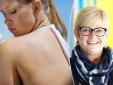 Jaarlijks krijgen 46.000 Belgen huidkanker: “Bij 95 procent is duidelijk aangetoond dat uv-blootstelling de boosdoener is”