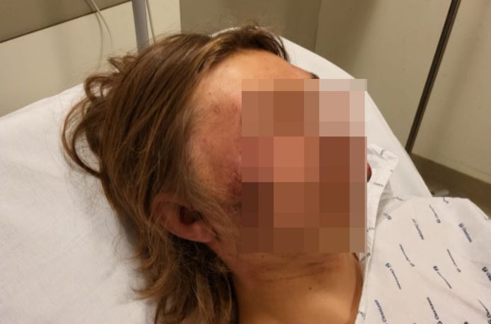 Ethan est sous le coup d’une incapacité d’un mois.