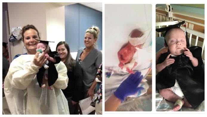 Foto links: een verpleegster bij de 'afstudeerceremonie'. Midden: Cullen Potter als prematuurtje toen hij al na 22 weken het leven zag. Foto rechts: de baby weegt inmiddels 2,7 kg.
