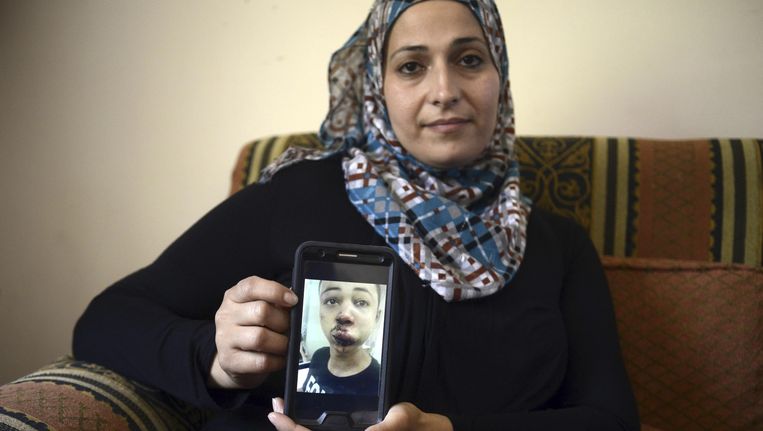 De moeder van Tariq Abu Khdeir laat een foto zien van haar gewonde zoon. Beeld ap