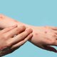Alles wat we nu weten over de apenpokken: ‘Nog veel te vroeg om te zeggen of mannen die seks hebben met mannen echt een groter risico lopen’
