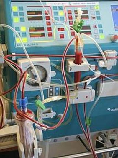 RIVM: minder zout scheelt 15.000 nierschadegevallen per jaar