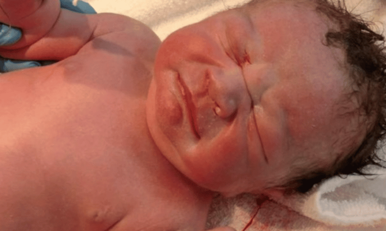 Worden Fysica een miljoen Foto van pasgeboren baby gaat het hele internet over: zie jij waarom?