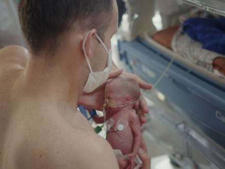 Een bevalling na 26 weken: voor het oog van de camera vocht Edith (940 gram, 27 cm) voor haar leven