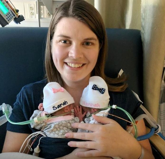 Katie Evans met haar twee kindjes Sarah en Hanah. Zij werden al na 25 weken geboren.
