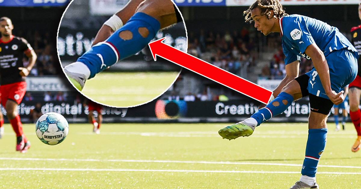 Hierom dragen sokken met gaten er | Nederlands voetbal | AD.nl