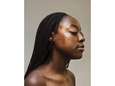 Fotoreeks toont vrouwen zonder make-up: acne mag geen taboe zijn