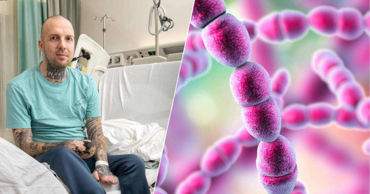 Steeds meer gevallen van besmettelijke streptokokken