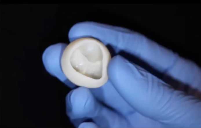 Une valve cardiaque en collagène fabriquée à l’aide d’une imprimante 3D.
