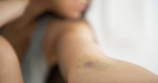 Eis: 4 jaar cel voor Nijverdaller na ernstige mishandeling anderhalf jaar oud kind.