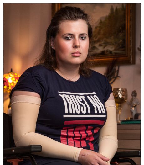 Levensgevaarlijke bacterie grijpt Liza (23), haar lichaam wordt zwart