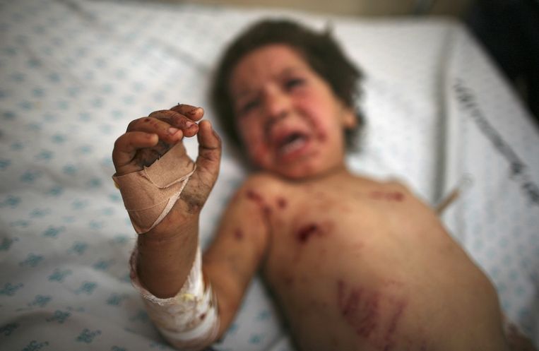 Een Palestijns meisje van vier wordt behandeld nadat ze gewond is geraakt bij een Israëlische luchtaanval. Beeld reuters