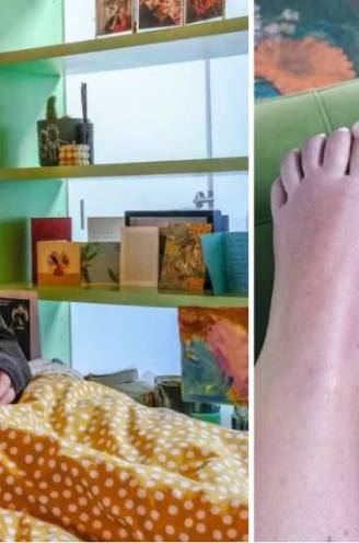 Zelfmoordziekte dwingt Liza (29) tot voetamputatie: “De pijn in mijn voet was erger dan bevallen zonder verdoving, blij dat ik ervan verlost ben”