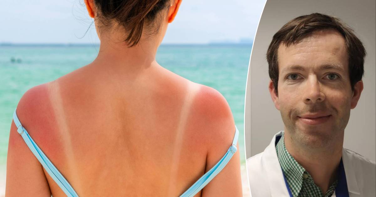 The Long-Term Effects of Sunburn: Can Past Sun Damage Lead to Skin Cancer?