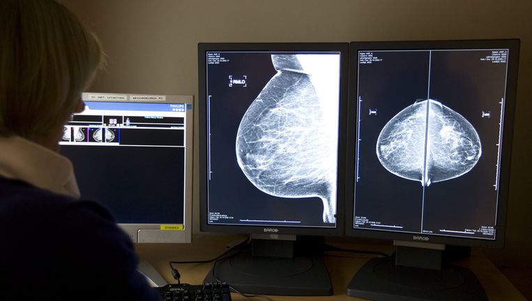 Een radioloog bekijkt digitale rontgenfoto's. Beeld anp