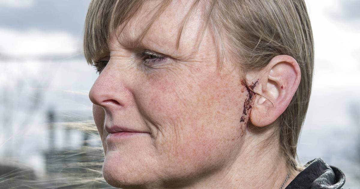 'Een enorme klap, nagels in m'n hoofd, zo voelt een oehoe-aanval'