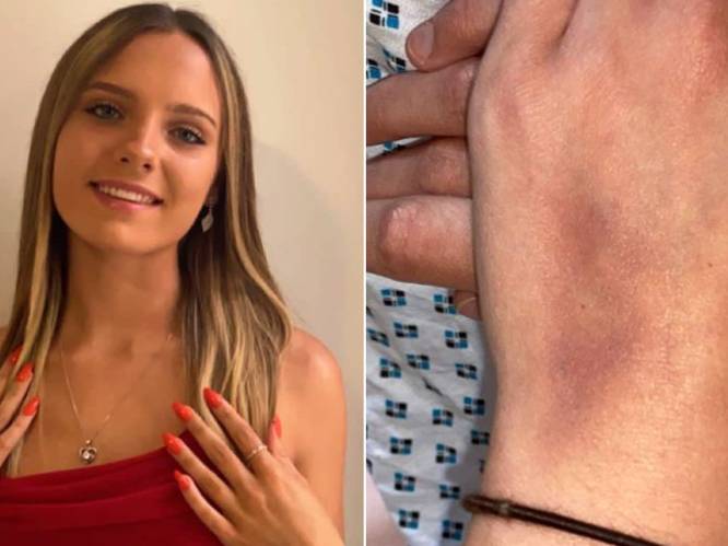 Britse vrouwen getuigen over beangstigende ‘naaldaanvallen’ in nachtclubs: “Gedrogeerd met een prik”