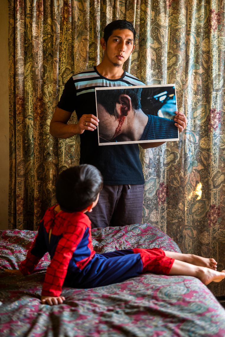Activist Fausto Jones laat zijn verwondingen zien. Zijn zoon kijkt toe. Beeld Foto Pablo E. Piovano