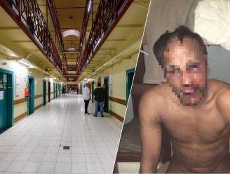 Gefolterde gevangene mag ziekenhuis verlaten en  moet niet meer terug naar de cel