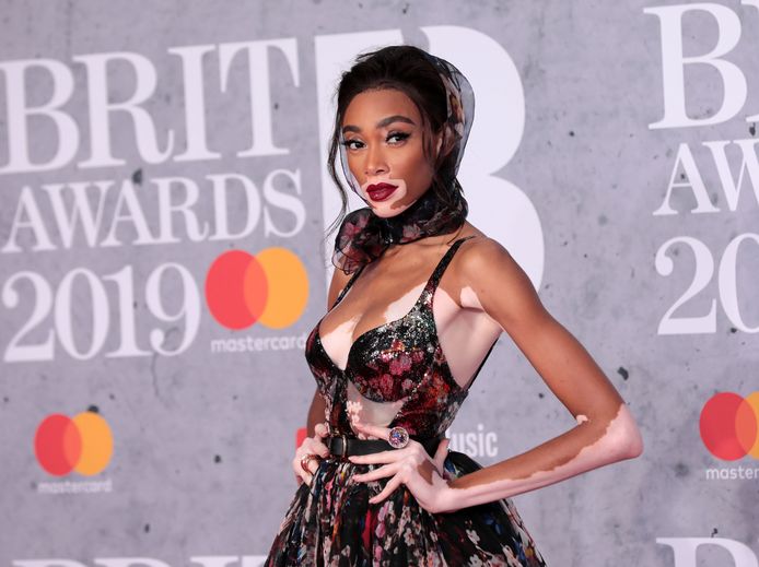 Topmodel Winnie Harlow.