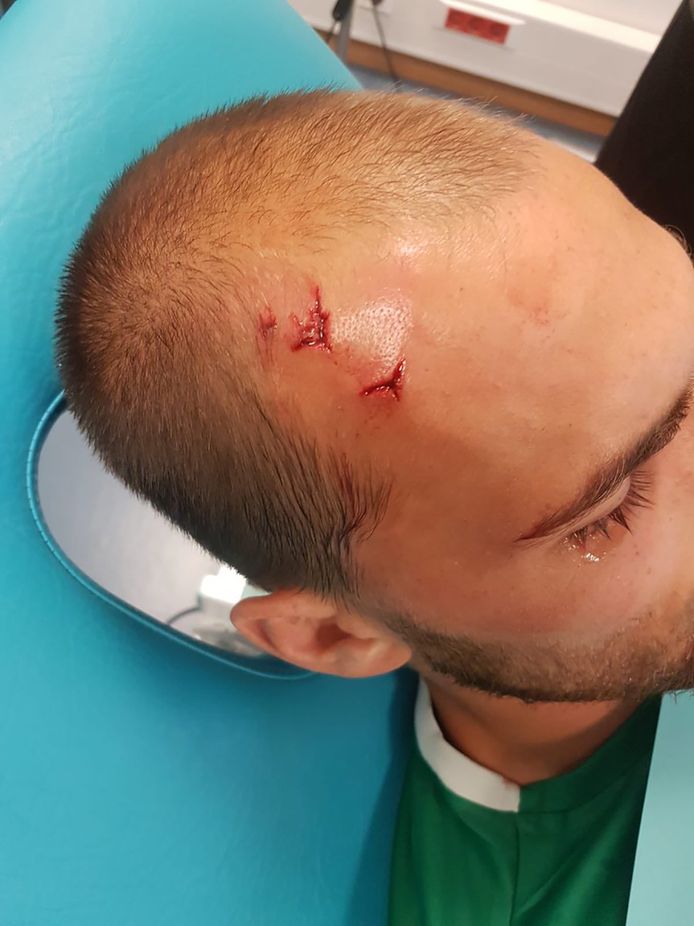 Bas Dost krijgt hechtingen in zijn hoofd nadat hij en zijn medespelers zijn aangevallen door hooligans tijdens een training van Sporting Lissabon.
