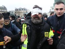Une figure des "gilets jaunes" blessée: "Je vais perdre mon oeil"