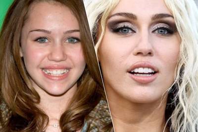 “Ze heeft haar tandvlees omhoog laten trekken”: tandarts onthult geheim achter Hollywoodglimlach van Miley Cyrus