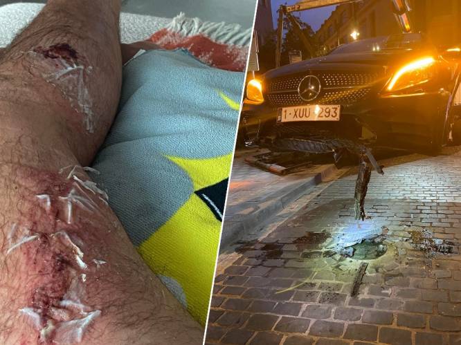 Marnix (46) belandt in het ziekenhuis nadat een inzinkbare paal zijn auto doorboort in Brussel: “Als de batterij geraakt was, was ik nu een gebraden kip”